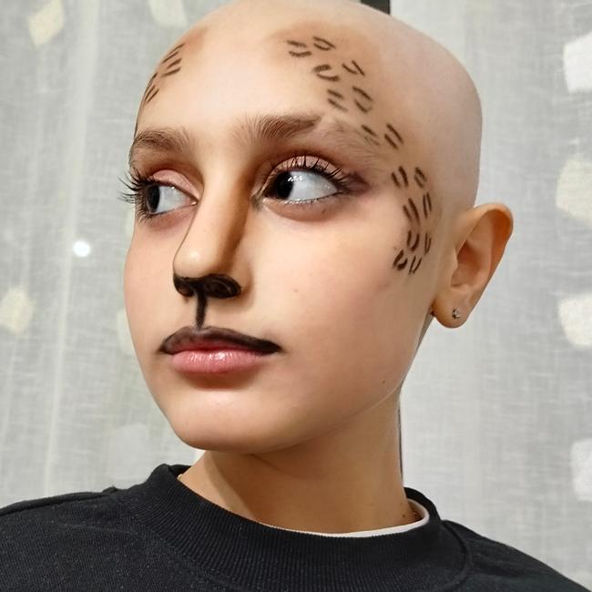 Alena ringrazia L' Oncoematologia Pediatrica