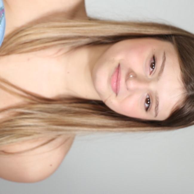 Atassia di Friedrich