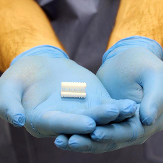 Un bronco 3D impiantato all'Ospedale Pediatrico Bambino Gesù dona il respiro a un bimbo di 5 anni